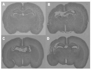 Fig 2. Hematoxylin and eosin (H&E) stain in coronal sections of 7-day-old rat brains revealed; (A) for control group in normoxia, (B) for control group in hypoxia only, (C) for geneticin-treated group before hypoxia, (D) for geneticin-treated group after hypoxia.
