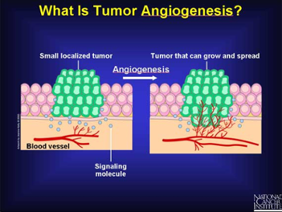 cancer angiogenesis