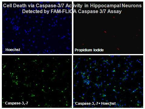 ell_death_via_caspase_3_activity_in_hippocampal_neurons_fam_flica_caspase_37_assay