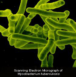mycobacterium-tuberculosis
